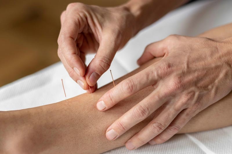 Jennifer stoneham Akupunktur Luzern